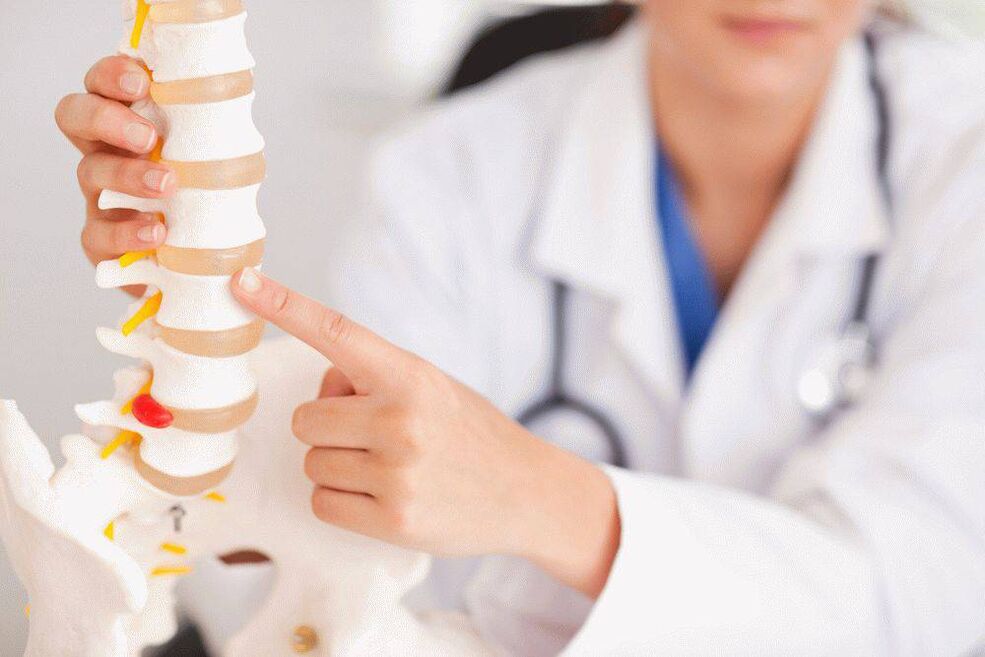 O médico sobre a osteocondrose e sua prevenção