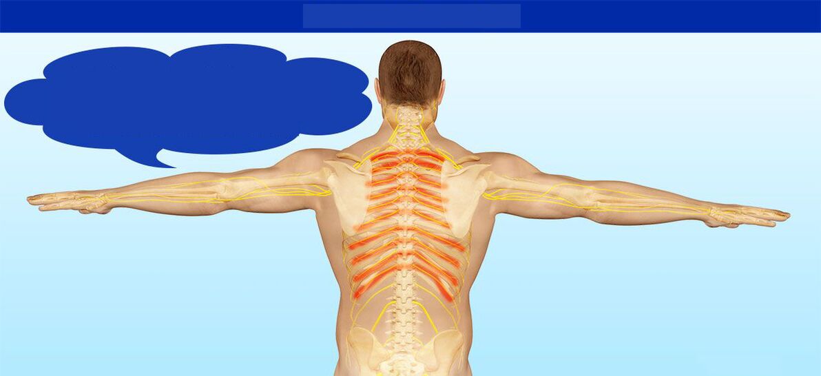 neuralgia intercostal