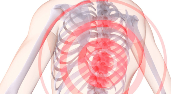 dor na coluna vertebral com osteocondrose torácica